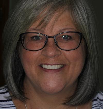 Smile Gallery - Gibside Dental