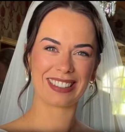 Smile Gallery - Gibside Dental