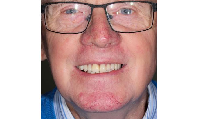 Smile Gallery -Gibside Dental