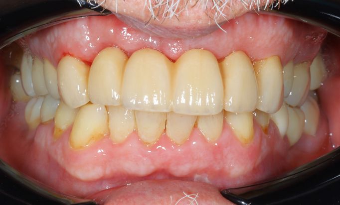 After -Gibside Dental