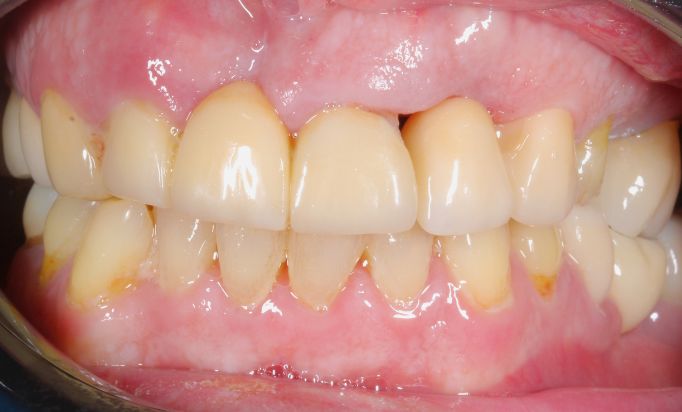 Before - Gibside Dental