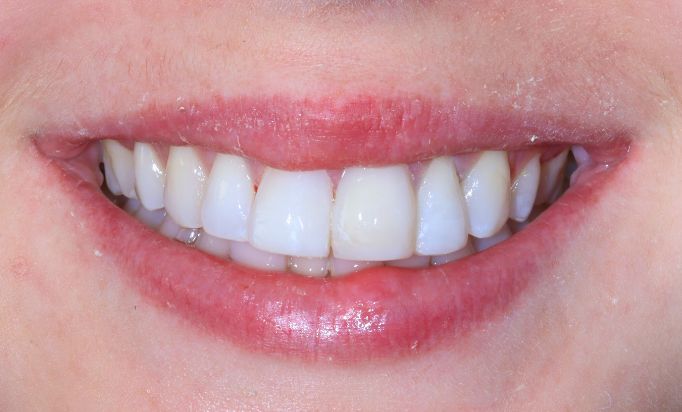 After -Gibside Dental