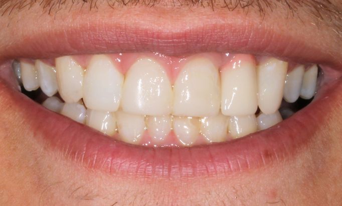 After -Gibside Dental