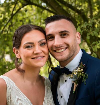 Smile Gallery - Gibside Dental