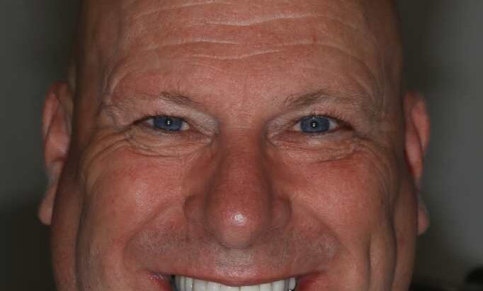 Smile Gallery -Gibside Dental