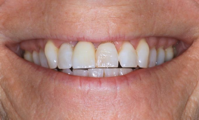 After -Gibside Dental