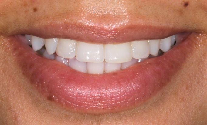 After -Gibside Dental