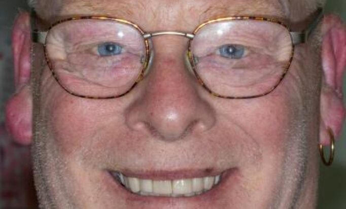 Smile Gallery -Gibside Dental