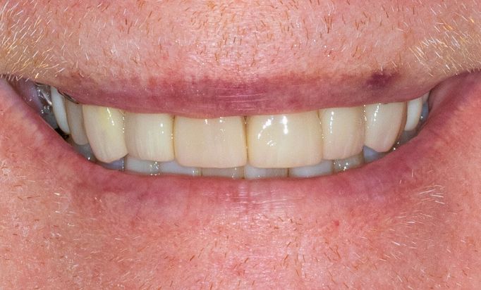 After -Gibside Dental