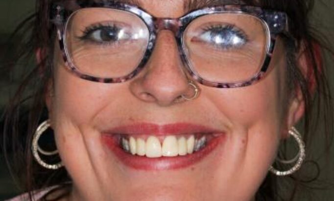 Smile Gallery -Gibside Dental