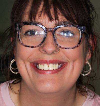 Smile Gallery - Gibside Dental