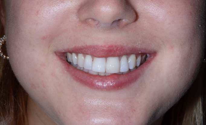 Smile Gallery -Gibside Dental