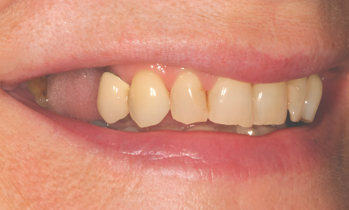 Before - Gibside Dental