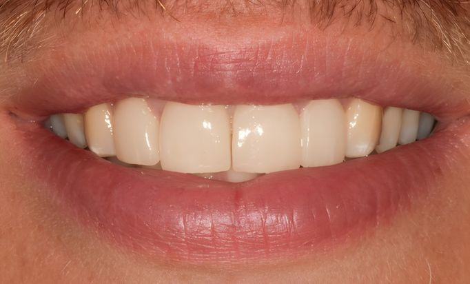 After -Gibside Dental